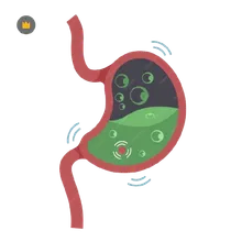 Gastroenterology: Bloating and Gas