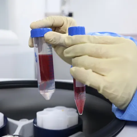 Blood tests and diagnostics