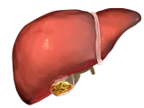 Hepatology: Fatty Liver