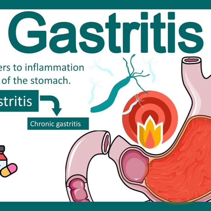 Stomach Pain & Disorders