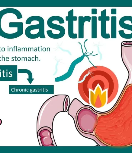 Stomach Pain & Disorders