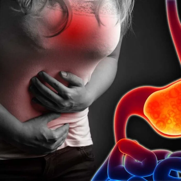 GERD/Acidity treatment success